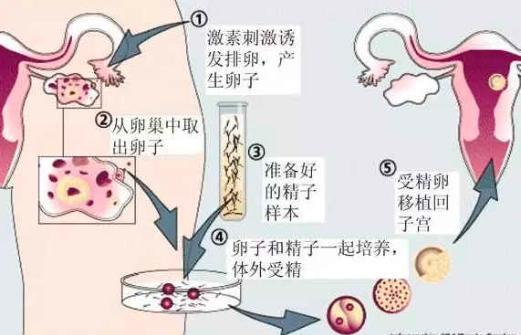 什么是代孕技术